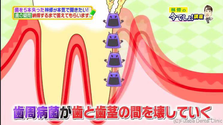 林修の今でしょ!講座 - 16.02.09 - 日本综艺 - MioMio弹幕网 - ( ^ω^)你是我的Master吗 - miomio.tv.mp4_002148704